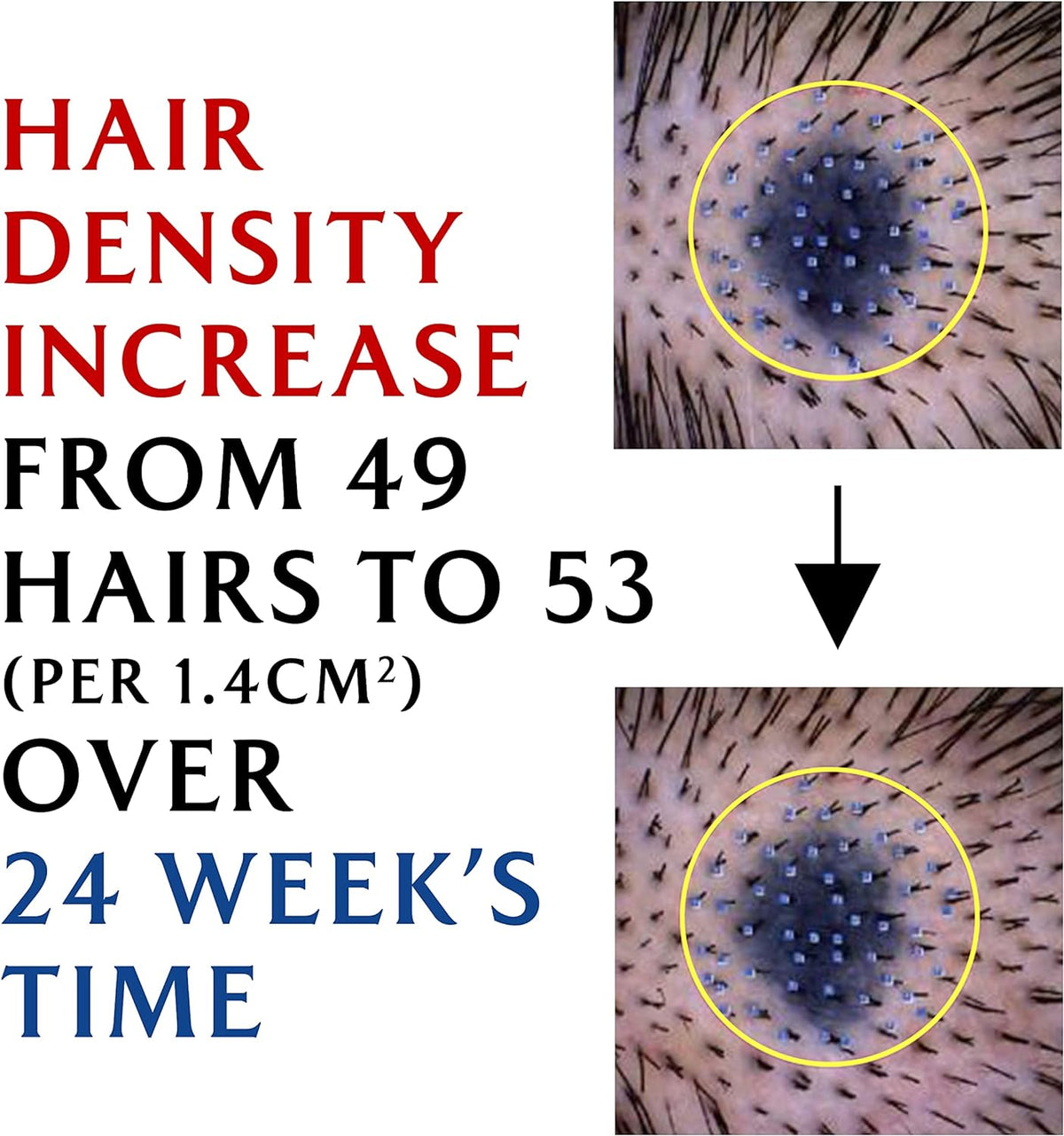 LADOR Dermatical Hair-Loss Shampoo